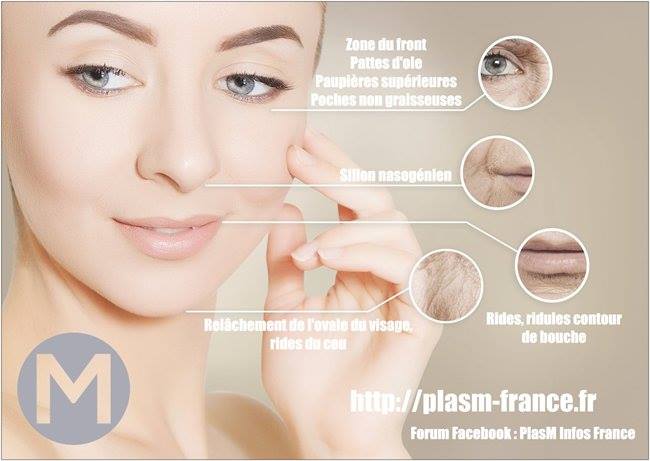 Soin anti age PlasM Soin anti age PlasM